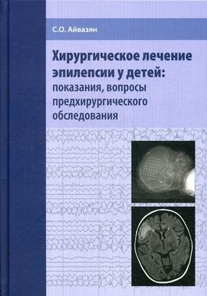 Хирургическое лечение эпилепсии у детей: показания и обследование | Surgical Treatment of Epilepsy in Children: Indications and Examination