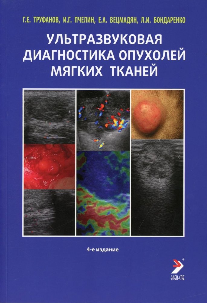 Ультразвуковая диагностика опухолей мягких тканей. 4-е изд | Ultrasound Diagnostics of Soft Tissue Tumors. 4th ed.