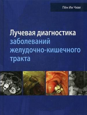 Лучевая диагностика заболеваний желудочно-кишечного тракта. Руководство | Radiological Diagnostics of Gastrointestinal Diseases: A Guide