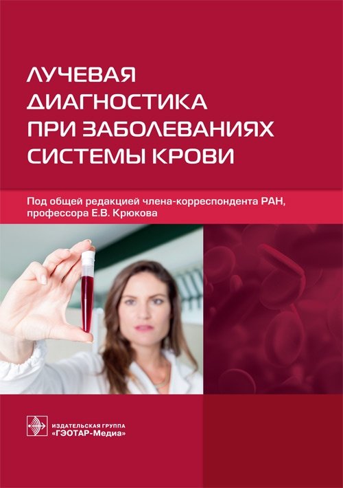Лучевая диагностика при заболеваниях системы крови | Radiological Diagnostics in Hematological Diseases