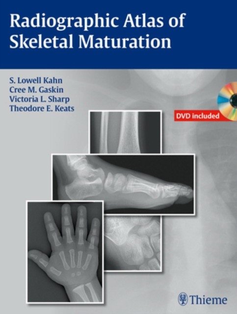 Radiographic Atlas of Skeletal Maturation | Radiographic Atlas of Skeletal Maturation