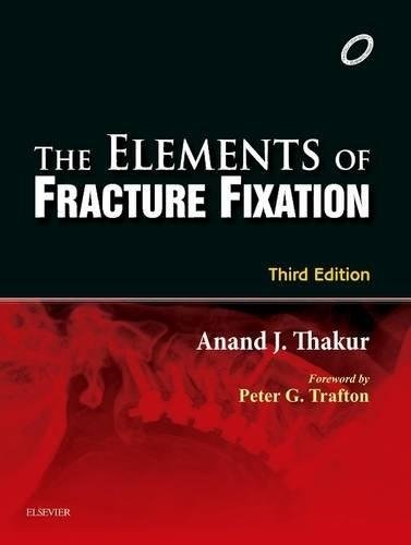 The Elements of Fracture Fixation | The Elements of Fracture Fixation