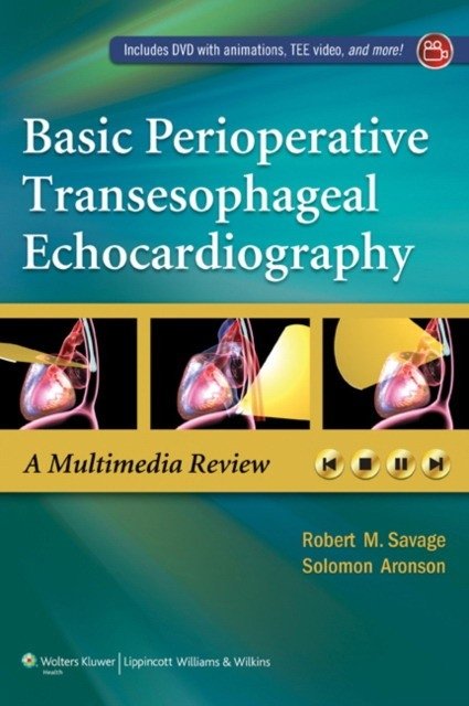 Basic Perioperative Transesophageal Echocardiography | Basic Perioperative Transesophageal Echocardiography: A Multimedia Review