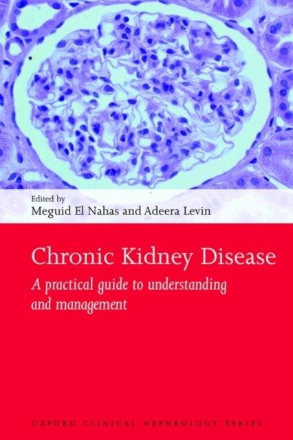 Chronic Kidney Disease | Chronic Kidney Disease