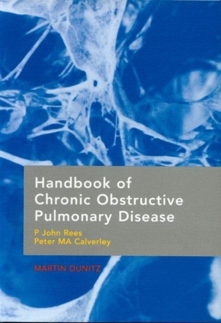 Handbook Of Chronic Obstructive Pulmonary Disease | Handbook of Chronic Obstructive Pulmonary Disease
