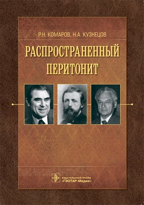Распространенный перитонит | Generalized Peritonitis