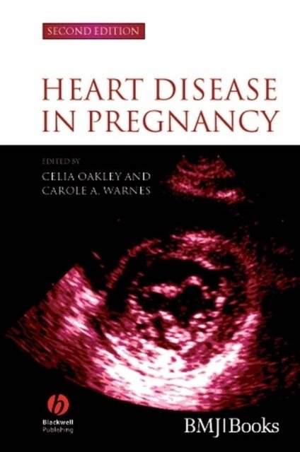 Heart Disease in Pregnancy | Heart Disease in Pregnancy