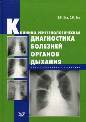 Клинико-рентгенологическая диагностика болезней органов дыхания. Общая врачебная практика | Clinical and radiological diagnosis of respiratory diseases. General medical practice