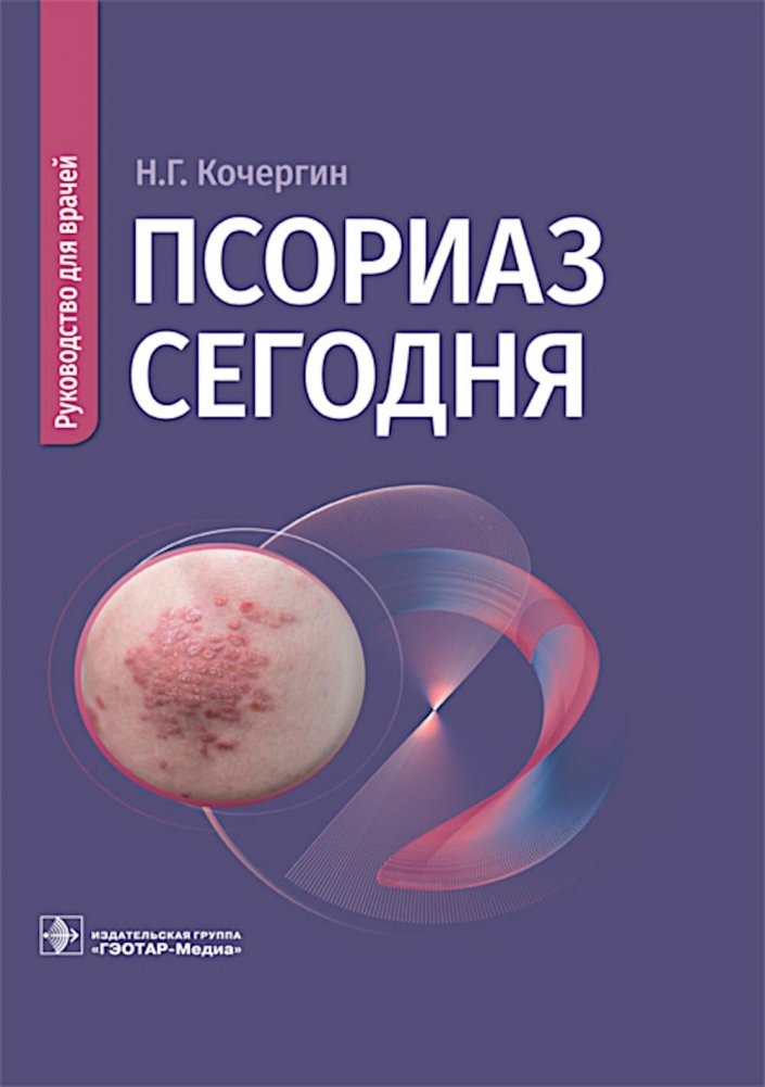 Псориаз сегодня: руководство для врачей | Psoriasis Today: A Guide for Physicians