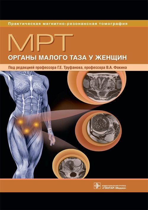 МРТ. Органы малого таза у женщин | MRI of Female Pelvic Organs