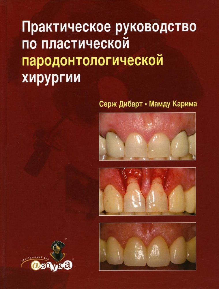 Практическое руководство по пластической парадонтологической хирургии | Practical Guide to Plastic Periodontal Surgery
