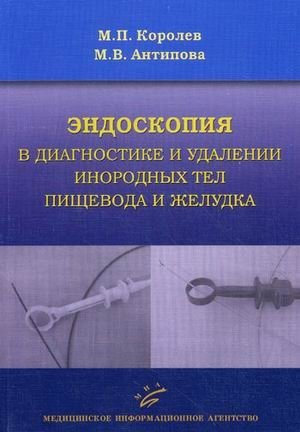 Эндоскопия в диагностике и удалении инородных тел пищевода и желудка