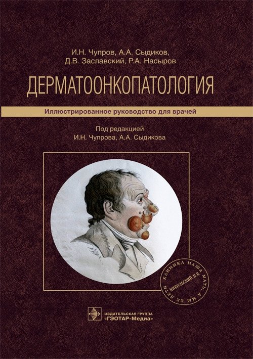 Дерматоонкопатология | Dermato-oncopathology