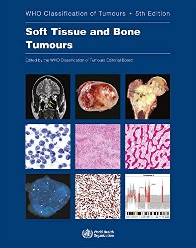Soft Tissue and Bone Tumours | Soft Tissue and Bone Tumours
