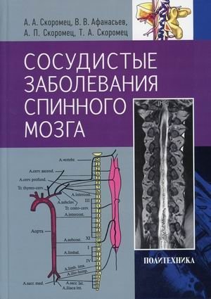 Сосудистые заболевания спинного мозга. Руководство для врачей | Vascular Diseases of the Spinal Cord: A Doctor's Guide