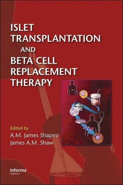 Islet transplantation and beta cell replacement therapy | Islet Transplantation and Beta Cell Replacement Therapy