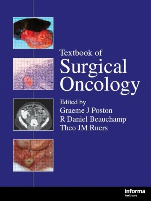 Textbook Surgical Oncology | Textbook Surgical Oncology