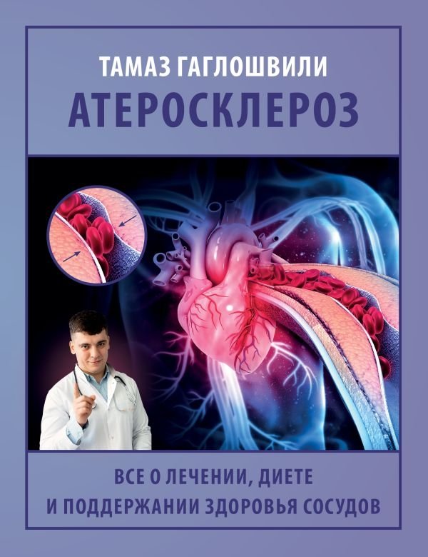 Атеросклероз. Все о лечении, диете и поддержании здоровья сосудов | Atherosclerosis: Treatment, Diet, and Vascular Health