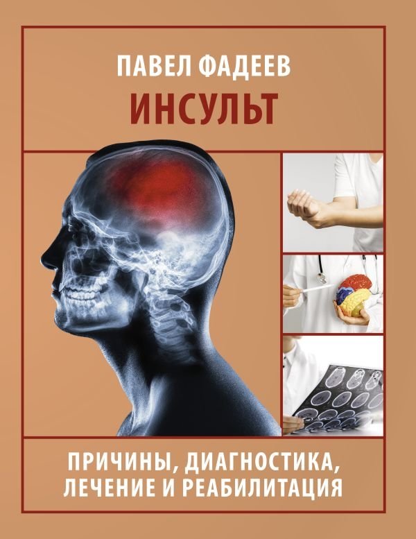 Инсульт. Причины, диагностика, лечение и реабилитация | Stroke: Causes, Diagnosis, Treatment, and Rehabilitation