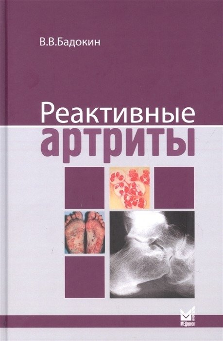 Реактивные артриты | Reactive Arthritis