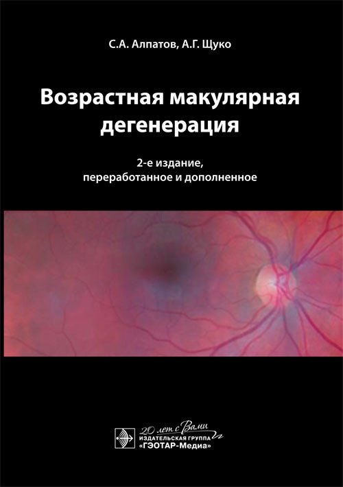 Возрастная макулярная дегенерация | Age-Related Macular Degeneration