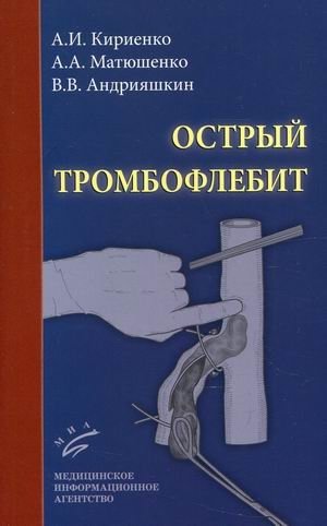 Острый тромбофлебит | Acute Thrombophlebitis