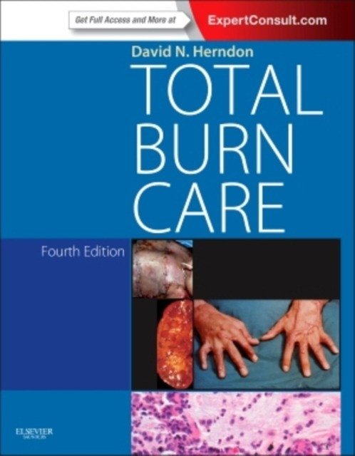 Total Burn Care | Total Burn Care