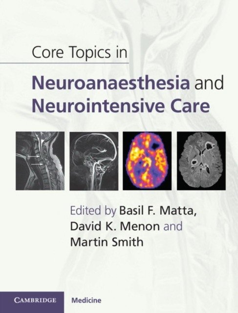 Core Topics in Neuroanaesthesia and Neurointensive Care | Core Topics in Neuroanaesthesia and Neurointensive Care