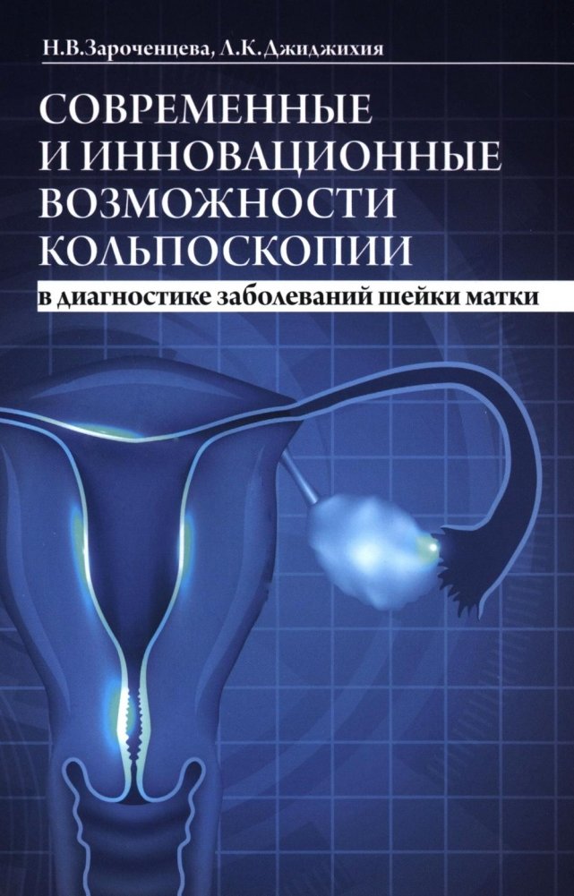 Современные и инновационные возможности кольпоскопии в диагностике заболеваний шейки матки. 2-е изд., доп.и перераб | Modern and Innovative Colposcopy Techniques in Diagnosing Cervical Diseases