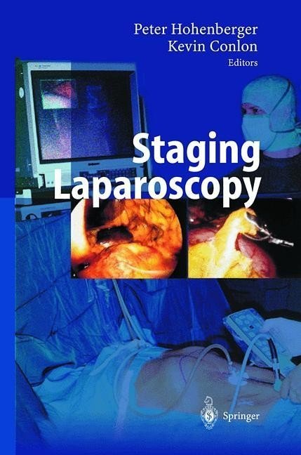 Лапароскопическое стадирование | Laparoscopic Staging