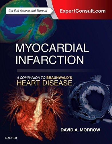 Инфаркт миокарда: Справочник по сердечным заболеваниям Брайнуолда | Myocardial Infarction: A Companion to Braunwald's Heart Disease