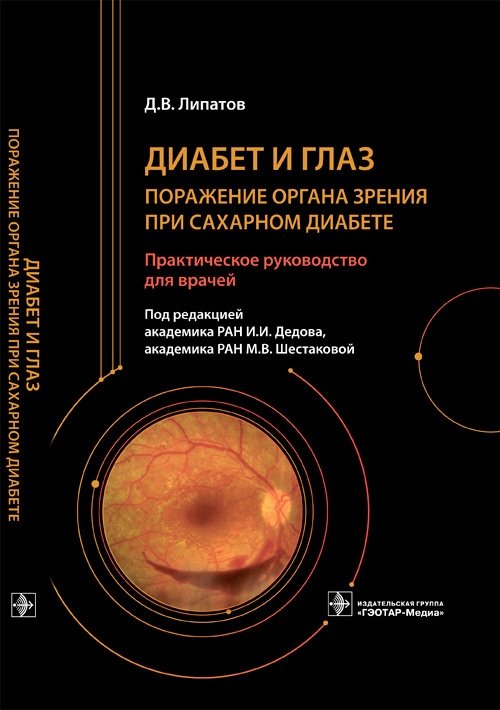 Диабет и глаз. Поражение органа зрения при сахарном диабете | Diabetes and the Eye: Ocular Complications in Diabetes Mellitus