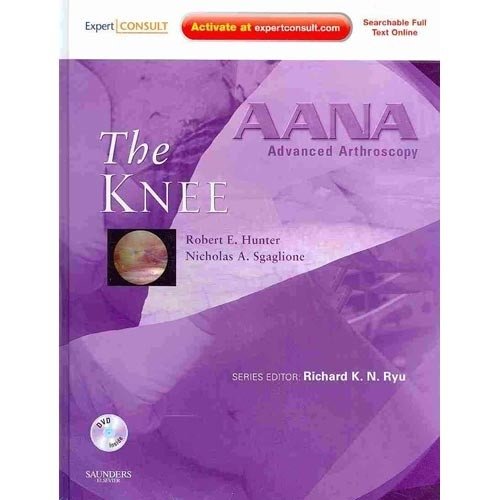 Aana advanced arthroscopy: the knee | Aana Advanced Arthroscopy: The Knee