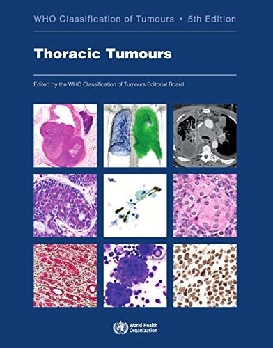 Thoracic Tumours | Thoracic Tumours