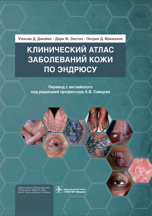 Клинический атлас заболеваний кожи по Эндрюсу | Andrews' Clinical Atlas of Skin Diseases