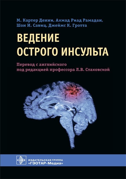Ведение острого инсульта | Management of Acute Stroke