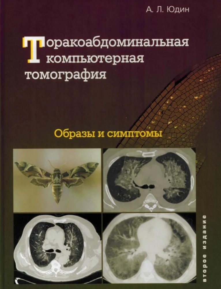 Торакоабдоминальная компьютерная томография. Образы и симптомы | Thoracoabdominal CT: Images and Symptoms