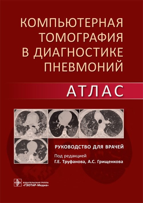 Компьютерная томография в диагностике пневмоний. Атлас | Computed Tomography in Pneumonia Diagnostics: An Atlas