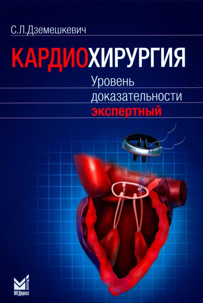 Кардиохирургия. Уровень доказательности экспертный | Cardiovascular Surgery: Expert Evidence Level