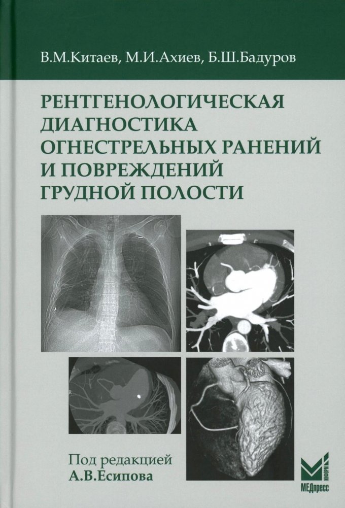 Рентгенологическая диагностика огнестрельных ранений и повреждений грудной полости. 2‑е изд., перераб. и доп | Thoracic Gunshot Wound Radiology and CT Diagnosis, 2nd Edition