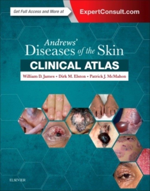 Andrews' Diseases of the Skin Clinical Atlas | Andrews' Diseases of the Skin Clinical Atlas