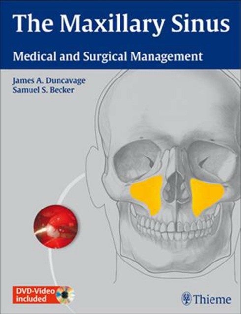The Maxillary Sinus: Medical and Surgical Management | The Maxillary Sinus: Medical and Surgical Management