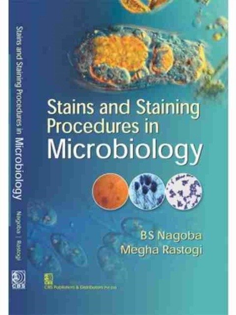Stains And Staining Procedures In Microbiology (Pb 2017) | Stains and Staining Procedures in Microbiology
