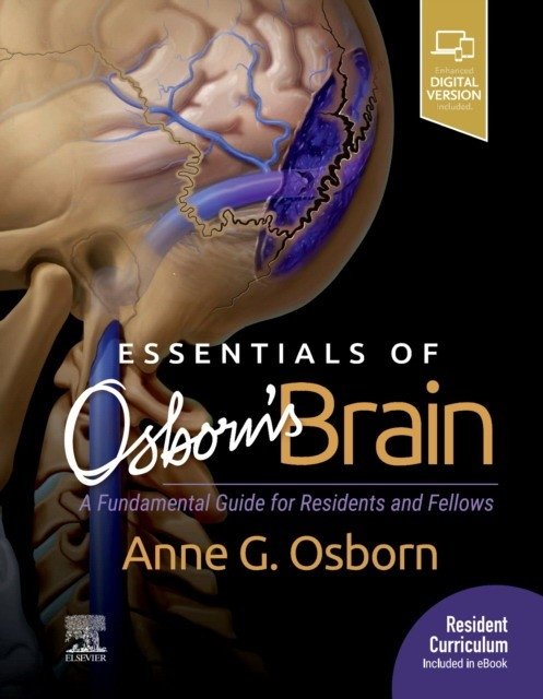 Essentials of Osborn's Brain | Essentials of Osborn's Brain
