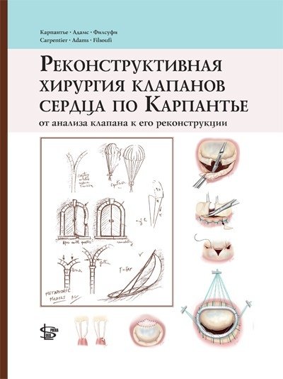Реконструктивная хирургия клапанов сердца по Карпантье: от анализа клапана до его реконструкции | Carpentier's Heart Valve Reconstruction Surgery: From Valve Analysis to Reconstruction
