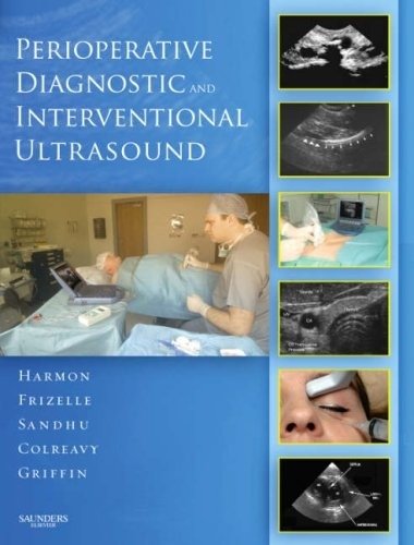 Perioperative Diagnostic and Interventional Ultrasound with DVD | Perioperative Diagnostic and Interventional Ultrasound with DVD