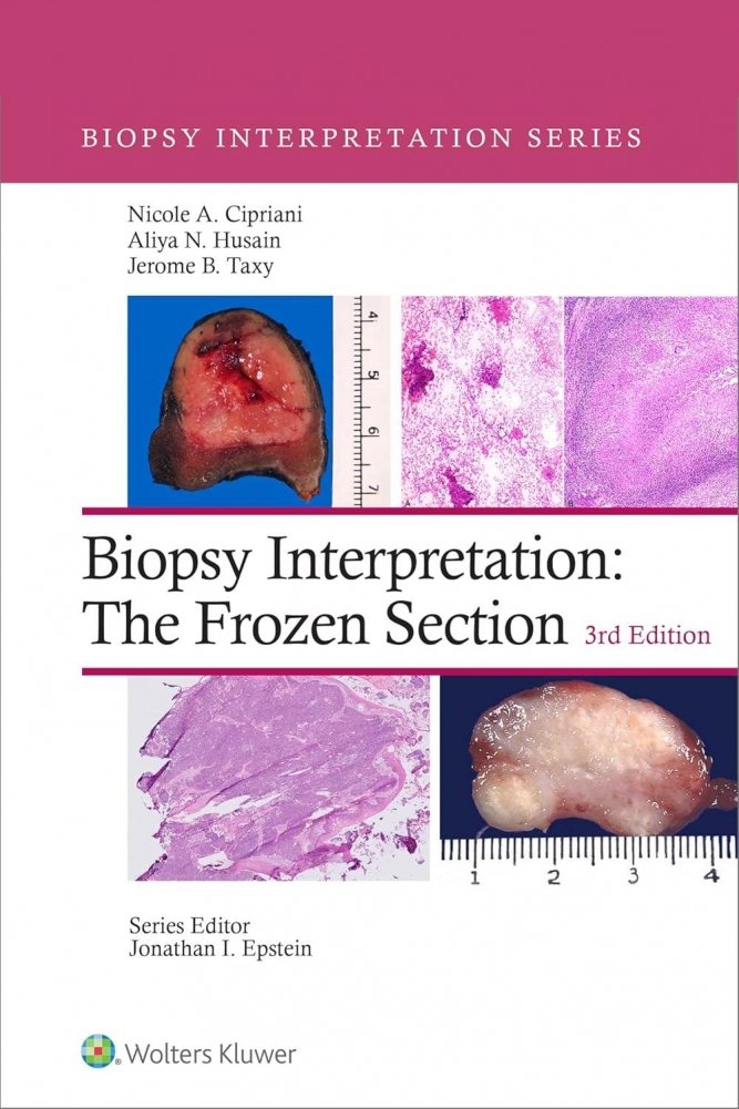 Biopsy Interpretation: The Frozen Section | Biopsy Interpretation: The Frozen Section