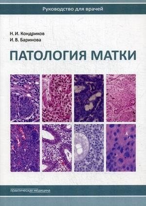 Патология матки. Руководство для врачей | Uterine Pathology: A Guide for Physicians