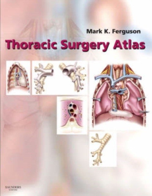 Thoracic Surgery Atlas | Thoracic Surgery Atlas
