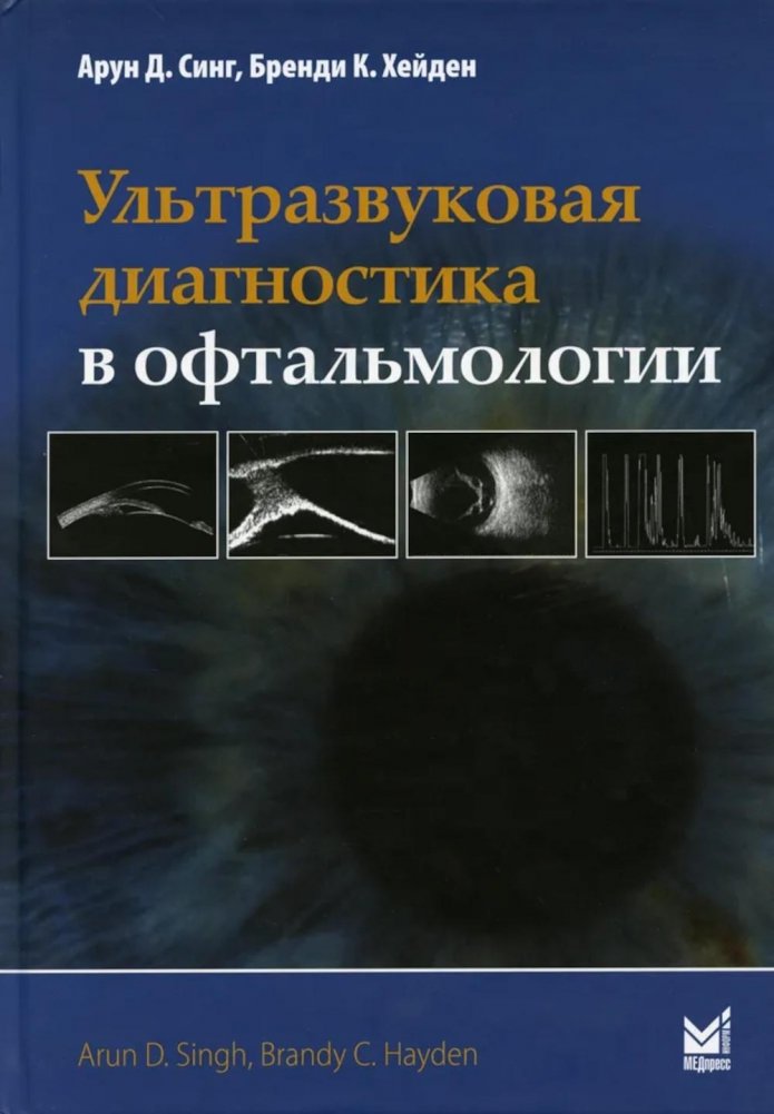 Ультразвуковая диагностика в офтальмологии. 3-е изд | Ultrasonic Diagnostics in Ophthalmology. 3rd ed.